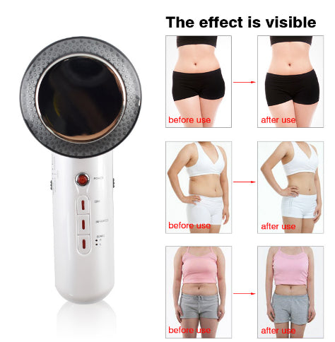 Beauty Care Slimming Device Handheld Ultrasound Body Fat Remove Massager - Premium 0 from Eretailer365.com - Just $46.79! Shop now at Eretailer365.com